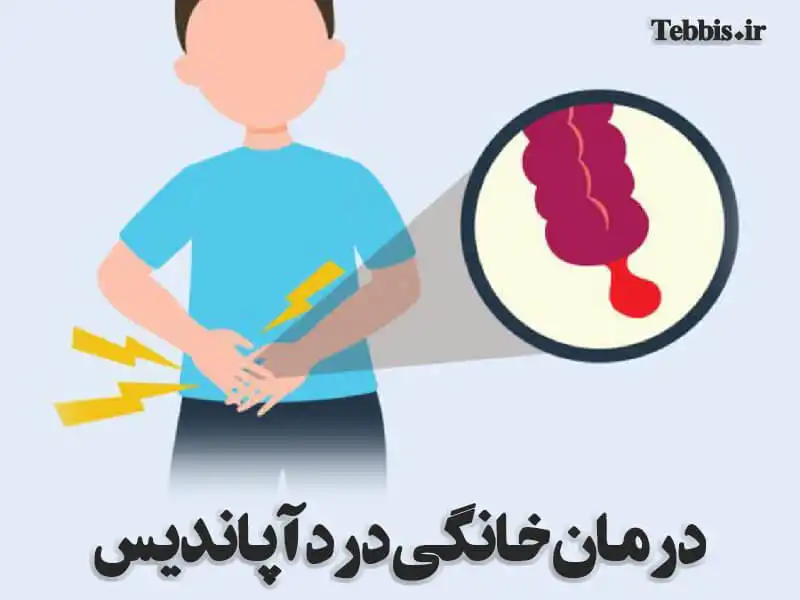 درمان آپاندیس یا عمل جراحی؟