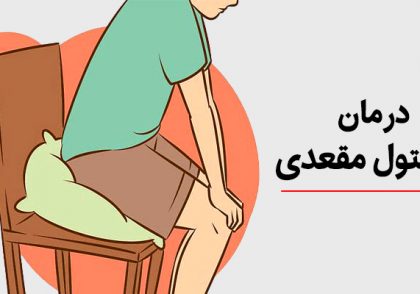 درمان فیستول مقعدی