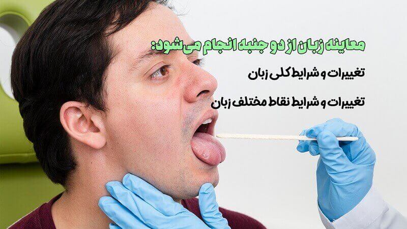 معاینه زبان طب سنتی