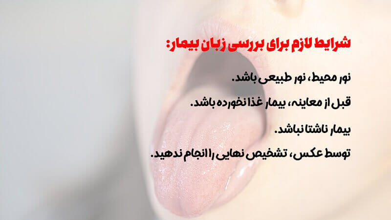 شرایط لازم معاینه زبان طب سنتی